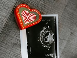 Embroidered heart next to an ultrasound image